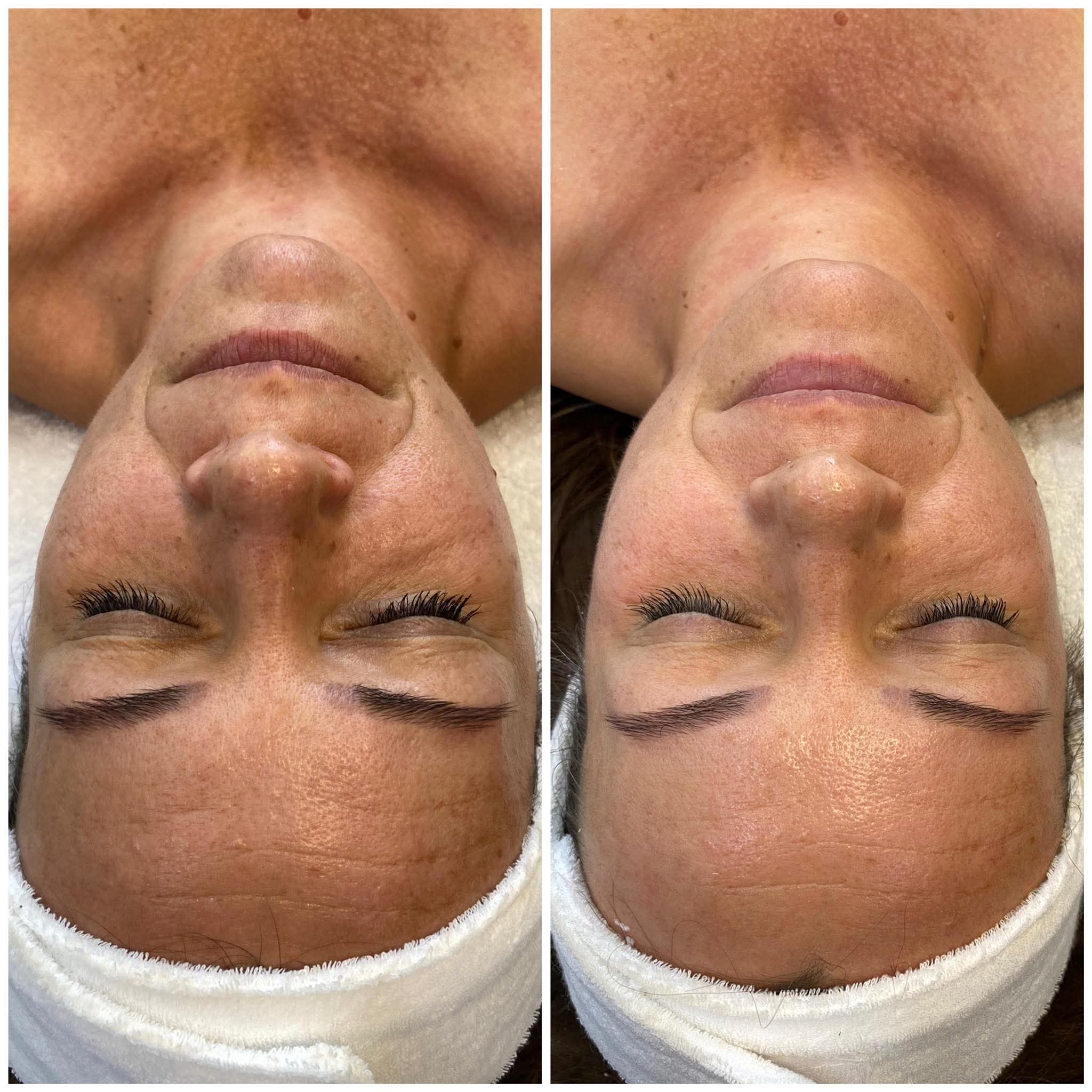kozmetika, debrecen, Viv Beauty Salon, power shape 2, alakformálás, fiatalítás